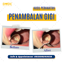 Dentalmate Dental Care | Dokter Gigi Jakarta Timur