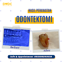 Dentalmate Dental Care | Dokter Gigi Jakarta Timur