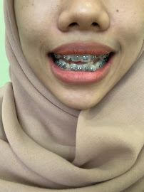 Dentalmate Dental Care | Dokter Gigi Jakarta Timur