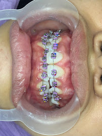 EDental Jakarta Selatan