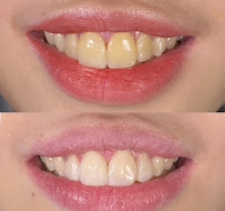 EDental Jakarta Selatan