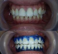 EDental Jakarta Selatan