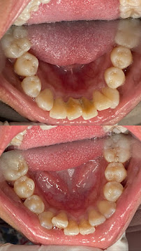 EDental Jakarta Selatan