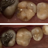 EDental Jakarta Selatan