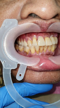 The Dental Station - Green Sedayu Mall | Spesialis Saraf Gigi, Dental Implant & Kawat Gigi Orthodontist
