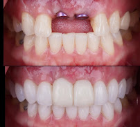 The Dental Station - Green Sedayu Mall | Spesialis Saraf Gigi, Dental Implant & Kawat Gigi Orthodontist