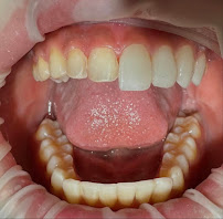 The Dental Station - Green Sedayu Mall | Spesialis Saraf Gigi, Dental Implant & Kawat Gigi Orthodontist