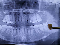 The Dental Station - Green Sedayu Mall | Spesialis Saraf Gigi, Dental Implant & Kawat Gigi Orthodontist