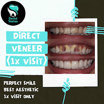 The Dental Station - Green Sedayu Mall | Spesialis Saraf Gigi, Dental Implant & Kawat Gigi Orthodontist in Jakarta