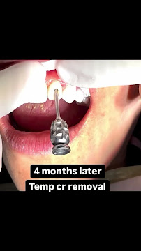 The Dental Station - Green Sedayu Mall | Spesialis Saraf Gigi, Dental Implant & Kawat Gigi Orthodontist
