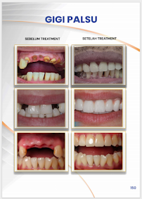 Klinik Dental Pandawa Jakarta Pusat | Dokter Gigi Spesialis