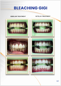 Klinik Dental Pandawa Jakarta Pusat | Dokter Gigi Spesialis