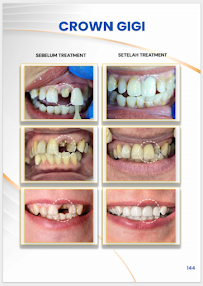 Klinik Dental Pandawa Jakarta Pusat | Dokter Gigi Spesialis
