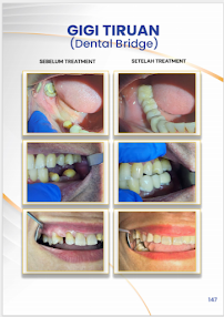 Klinik Dental Pandawa Jakarta Pusat | Dokter Gigi Spesialis
