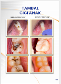 Klinik Dental Pandawa Jakarta Pusat | Dokter Gigi Spesialis