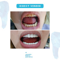Jakarta Dental Aesthetic