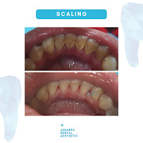 Jakarta Dental Aesthetic
