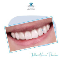 Jakarta Dental Aesthetic
