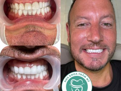 Tran Thanh Lam Cosmetic Dental Clinic - Phu Quoc