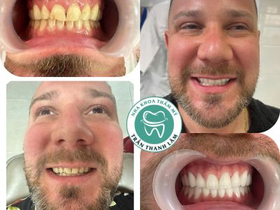 Tran Thanh Lam Cosmetic Dental Clinic - Phu Quoc