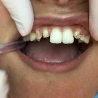 Cabinet Dentaire Bardo Tunis DR. Khaoula Jebali