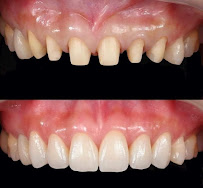 Dental Office Dr.Ahmed BESROUR