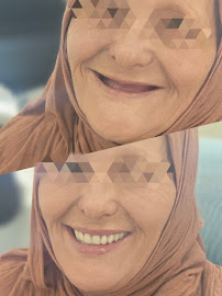 Dentiste Dr MARWA BEN DHIA BOUMAIZA