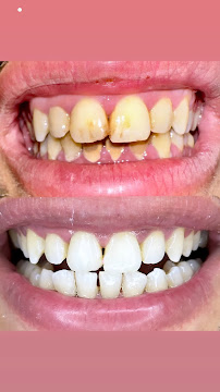 Cabinet dentaire Dr Amine Mlayah - Implantologie, esthétique dentaire, prothèses dentaire, invisalign