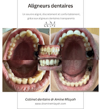 Cabinet dentaire Dr Amine Mlayah - Implantologie, esthétique dentaire, prothèses dentaire, invisalign