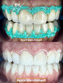 Cabinet dentaire Dr Amine Mlayah - Implantologie, esthétique dentaire, prothèses dentaire, invisalign