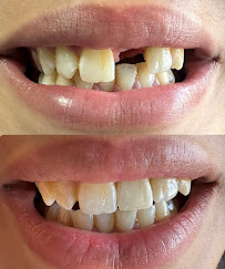 Cabinet dentaire Dr Amine Mlayah - Implantologie, esthétique dentaire, prothèses dentaire, invisalign