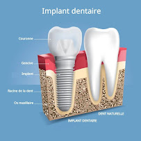 Cabinet dentaire Dr Amine Mlayah - Implantologie, esthétique dentaire, prothèses dentaire, invisalign