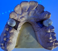 Cabinet dentaire Dr Amine Mlayah - Implantologie, esthétique dentaire, prothèses dentaire, invisalign