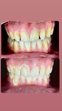 Cabinet dentaire Dr Amine Mlayah - Implantologie, esthétique dentaire, prothèses dentaire, invisalign