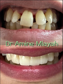 Cabinet dentaire Dr Amine Mlayah - Implantologie, esthétique dentaire, prothèses dentaire, invisalign