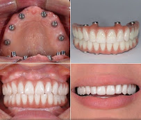 Cabinet dentaire Dr Amine Mlayah - Implantologie, esthétique dentaire, prothèses dentaire, invisalign