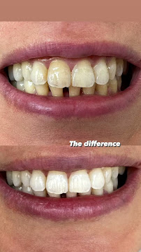 Cabinet Dentaire Dr Anouer Taboui - Tunis,Tunisie - عيادة علاج جذور الأسنان، علاج الأسنان التحفظي و التجميلي. سكرة، تونس