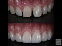 Dental Design Clinic - คลินิกทันตกรรมเด็นทัลดีไซน์