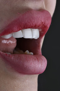 Cabinet Dr Wafa Zaiem - Dentisterie Esthétique et Implantologie