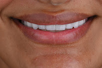 Cabinet Dr Wafa Zaiem - Dentisterie Esthétique et Implantologie