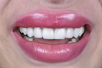 Cabinet Dr Wafa Zaiem - Dentisterie Esthétique et Implantologie