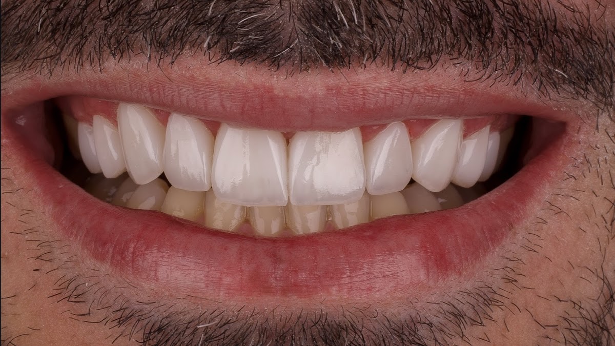 Dental Clinic Dentiste Tunis : Dr Bedis Mliki dental clinic in Tunis