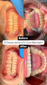 Cabinet dentaire Dr Omar Mathlouthi