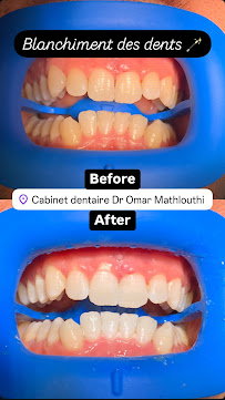 Cabinet dentaire Dr Omar Mathlouthi