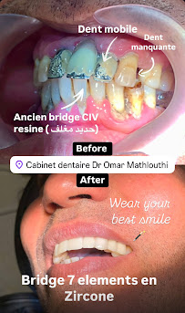Cabinet dentaire Dr Omar Mathlouthi