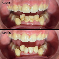 Cabinet Dr. Omar Chatti - Dentiste