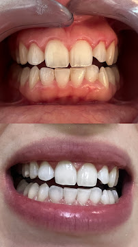 Cabinet Dr Ben Charfeddine Yassine, médecin dentiste