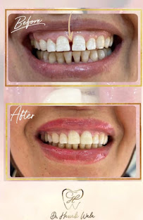 Dr Harrabi Wala Dental Clinic