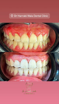Dr Harrabi Wala Dental Clinic