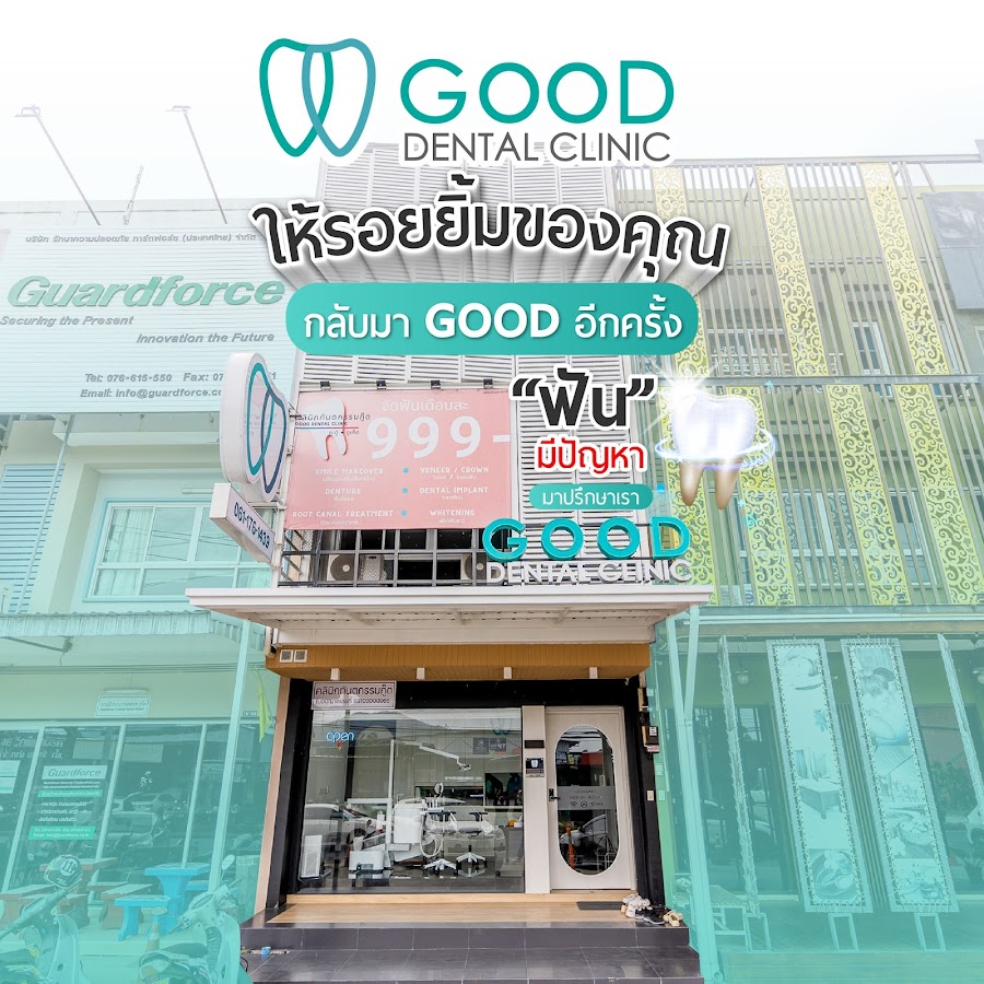 Good dental clinic Kathu Phuket คลินิกทันตกรรมกู๊ด กะทู้ จัดฟัน ฟอกฟันขาว รักษารากฟัน รากฟันเทียม ครอบฟัน วีเนียร์ ภูเก็ต